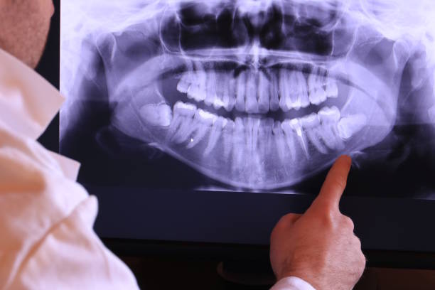 Best Emergency Broken Tooth Repair in Sylvania, OH